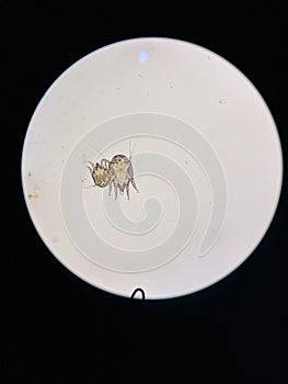 Otodectes cynotis, or ear mites under the microscope. This mites are found in cat's ear. it can causing otitis externa photo
