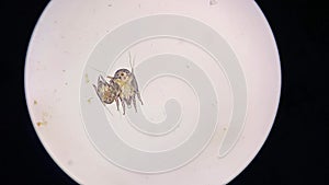Otodectes cynotis, or ear mites under the microscope. This mites are found in cat's ear. it can causing otitis externa