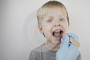 An otolaryngologist examines a child`s throat with a wooden spatula. A possible diagnosis is inflammation of the pharynx, tonsils photo