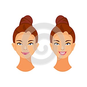 Otoplasty vector illustration photo