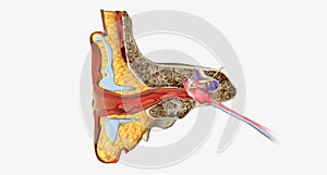 An outer ear infection, also called otitis externa photo