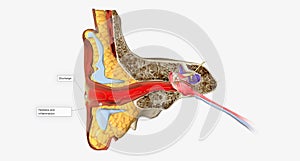 An outer ear infection, also called otitis externa photo