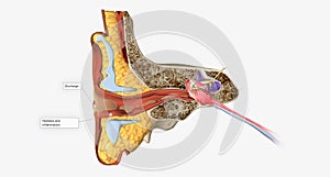 An outer ear infection, also called otitis externa photo
