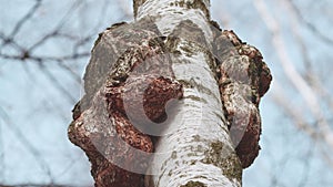 Outgrowth On A Birch Tree Trunk. Burl On A Birch Tree Trunk. Wood Suvel. Tree Diseases. Gimbal Stabilize.