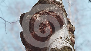 Outgrowth On A Birch Tree Trunk. Burl On A Birch Tree Trunk. Wood Suvel. Tree Diseases. Gimbal Stabilize.