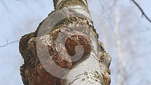 Outgrowth On A Birch Tree Trunk. Burl On A Birch Tree Trunk. Wood Suvel. Tree Diseases. Gimbal Stabilize.