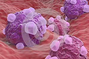 Ovarian cancer cell variations - closeup view 3d illustration