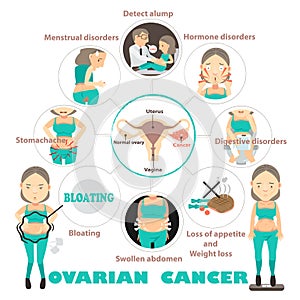 Ovarian cancer photo