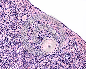 Ovarian cortex. Follicles