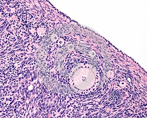 Ovarian cortex. Follicles photo