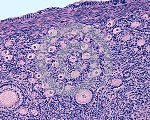 Ovarian cortex. Follicles