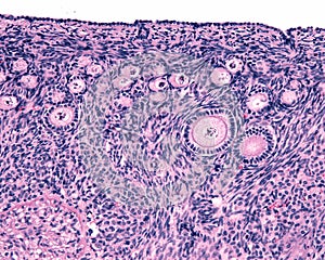 Ovarian cortex. Follicles photo