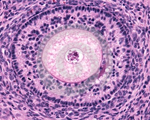 Ovarian cortex. Seconday follicle photo