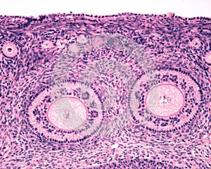 Ovarian cortex. Seconday follicles