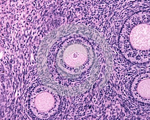 Ovarian cortex. Seconday follicles