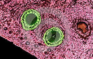 Ovarian follicles. Light microscopy