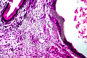 Ovarian mucinous cystadenoma, light micrograph