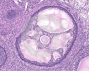 Ovary. Antral or tertiary follicle