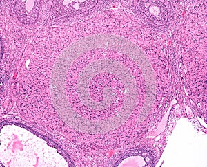 Ovary. Corpus luteum