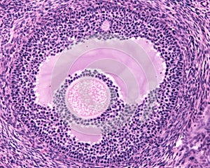 Ovary. Early tertiary follicle