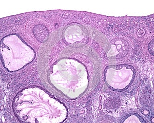 Ovary. Ovarian follicles photo