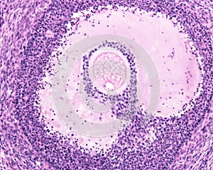 Ovary. Follicular atresia