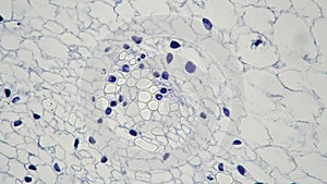 Ovary of Lilium in transversal section under microscope 400x against bright field