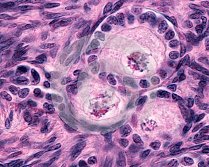 Ovary. Primary follicle