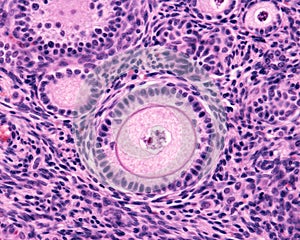 Ovary. Primary follicle photo