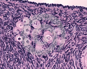 Ovary. Primordial follicles