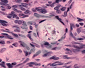 Ovary. Primordial follicles