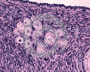 Ovary. Primordial follicles photo