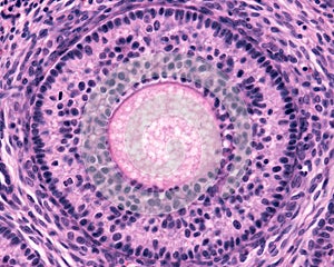 Ovary. Secondary follicle