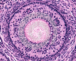 Ovary. Secondary follicle photo