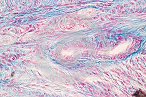 Ovary and Testis human cells under microscope.