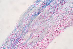 Ovary and Testis human cells under microscope.