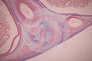 Ovary and Testis human cells under microscope.