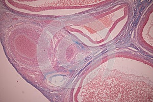 Ovary and Testis human cells under microscope.