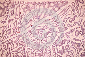 Ovary and Testis human cells under microscope.