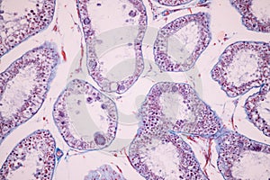 Ovary and Testis human cells under microscope.