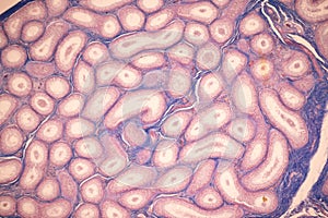 Ovary and Testis human cells under microscope.