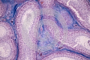 Ovary and Testis human cells under microscope.