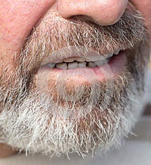 Overgrown beard man