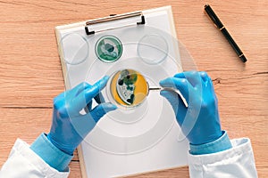 Overhead view of laboratory technician analyzing petri dish bacterial cultures