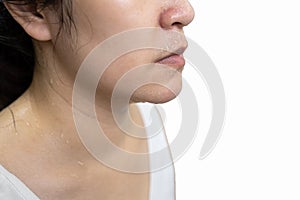 Overheated lady girl with sweaty skin on the face,excessive sweating,water droplets of sweat on her nose,mouth and body from hot