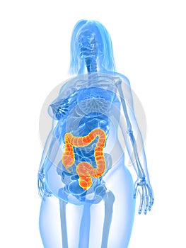 Overweight female - colon