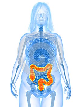 Overweight female - colon