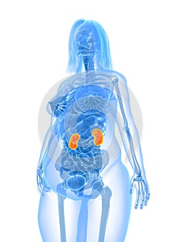 Overweight female - kidneys