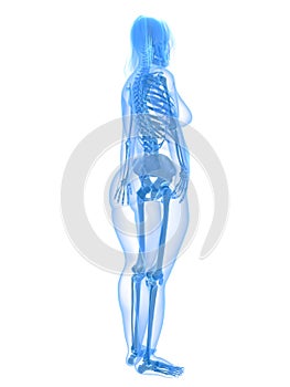 Overweight female - skeleton