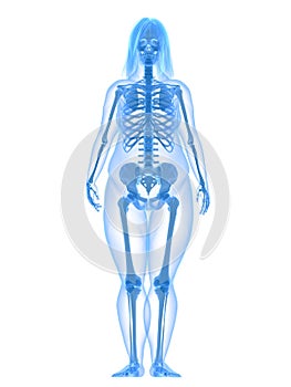 Overweight female - skeleton